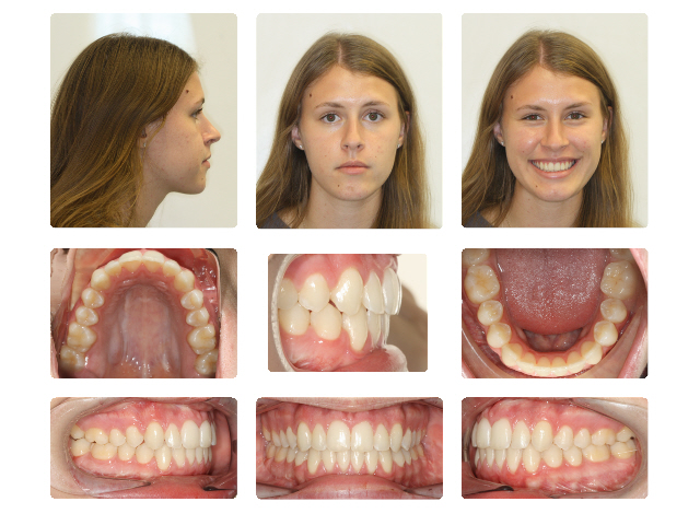 surgical after