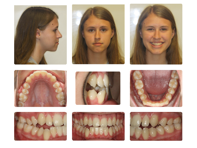 surgical before